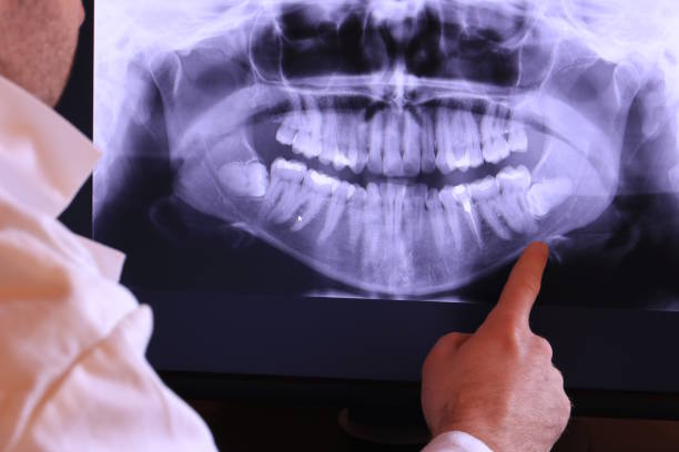 Best Emergency Dental Care for Broken or Chipped Teeth in West Canton, NC