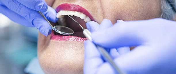 Best Emergency Treatment for Dental Infections or Abscesses in West Canton, NC